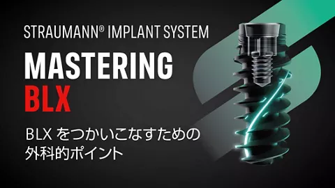 Straumann® BLXインプラントシステム｜ストローマン・ジャパン