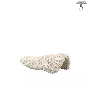 maxgraft bonebuilder, individual block