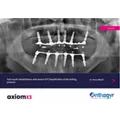 Clinical Case - Axiom X3® - Dr Bruet