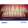 Clinical Case - Axiom X3® - Dr Verdino