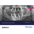 Clinical Case - Axiom X3® - Dr Carrotte