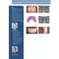 Clinical Case - Axiom® TL - Dr Norré & Mr Donck