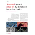 Clinical Article - CAD/CAM - OsteoSafe® - Dr Khoury & Revise - Implants