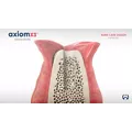 Axiom X3® Bone is Gold Video