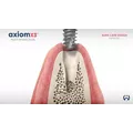 Axiom X3® Bone is Gold Video