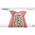 Axiom X3® Bone is Gold Video