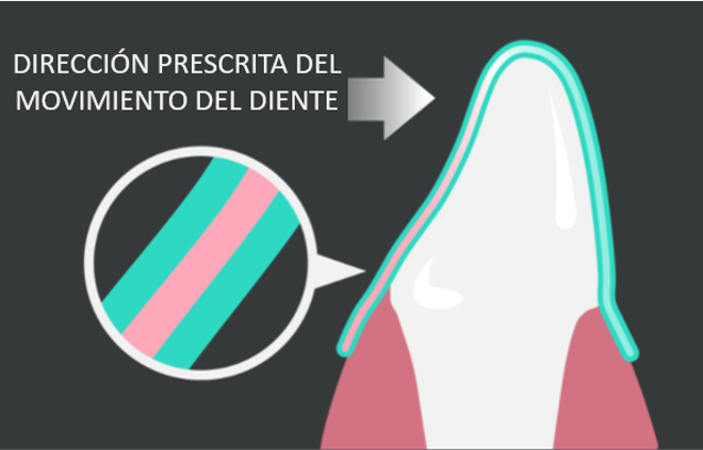 movimento previsto del dente