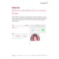 TRIOS - How to Perform a Workflow for an Implant Bridge when using TRIOS