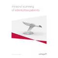 TRIOS - How to scan edenulous patients