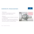 Ti Abutment Tips