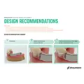 Straumann® Zirconia Sleeve on CoreBar™