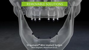 Straumann® Zygomatic Implant System