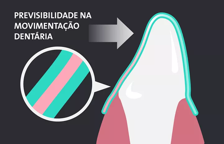 movimento previsto del dente