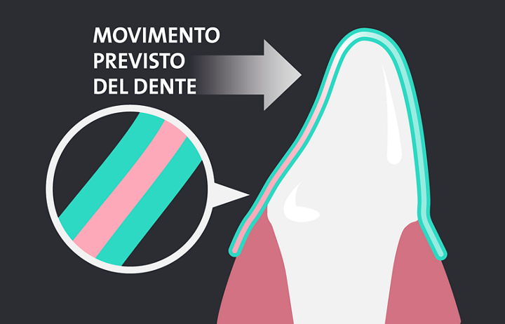 movimento previsto del dente