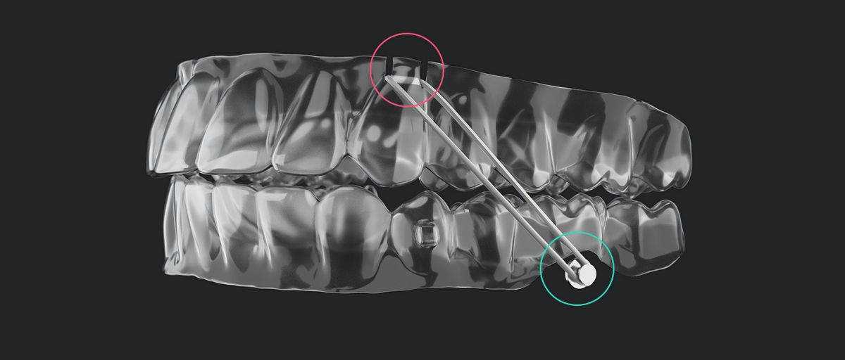 Invisalign & Clear Correct - Leone Dental Group