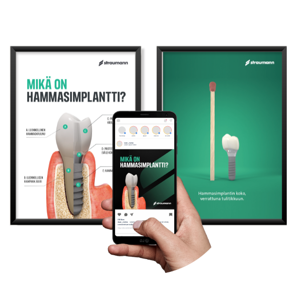 posters with dental implant, hand holding a smartphone
