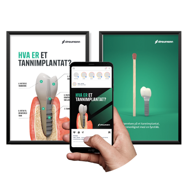 posters with dental implant, hand holding a smartphone