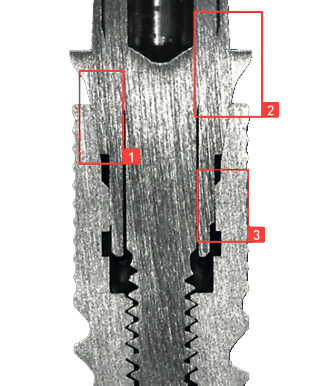 MEDENTiKA ABUTMENT CX 1200 * compatible with Medentis Medical® / ICX®