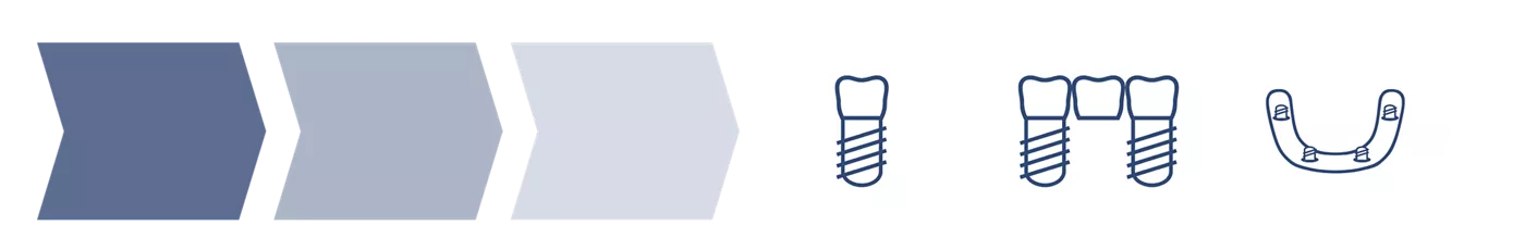 Darstellung des digitalen Workflows von Anthogyr. 