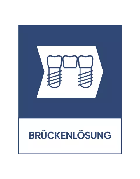 Digitaler Workflow von Anthogyr – Schritt Brückenlösung. 