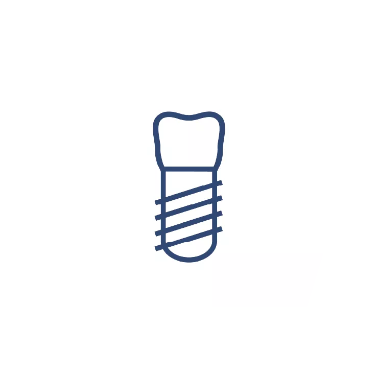 Digitaler Workflow von Anthogyr – Schritt Einzelzahn-ohne Text. 