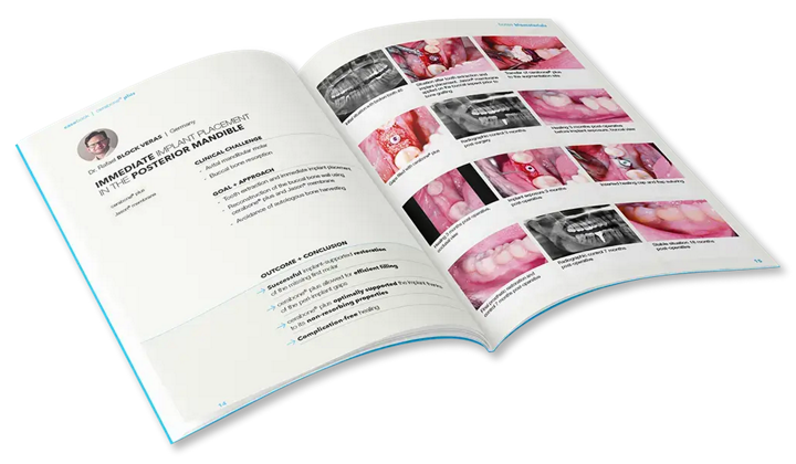 Open CERABONE® PLUS clinical casebook