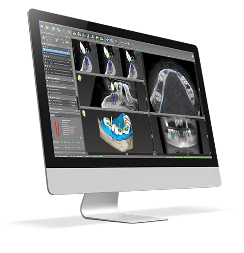 Digital for Labs - Straumann products