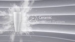 【裁断済み】2023 Dental Implantology 1-6号 セット Neodent Zi Ceramic Implant System | A new mindset