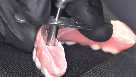 Drilling and removal of the Pin Capture NeoConvert using the Drill Guide For Handpiece 1.5mm NeoConvert.