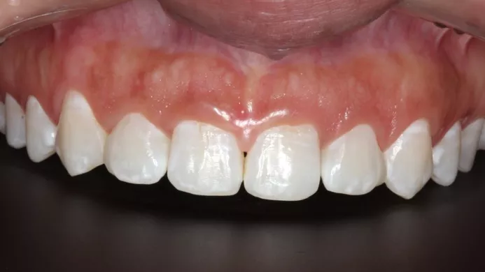 Initial clinical aspect of the case