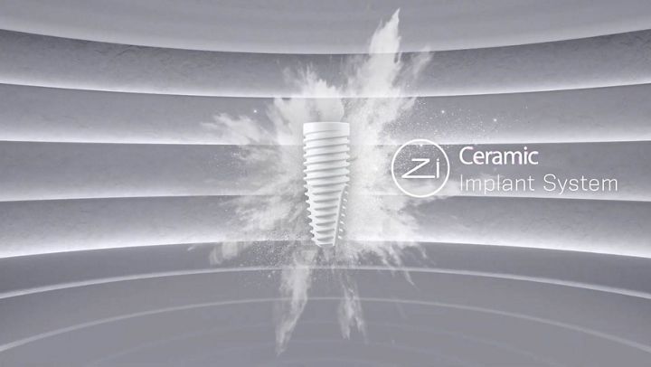 erstes-neodent-implantat