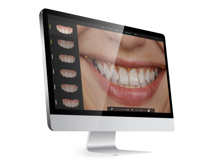 Software Smilecloud en monitor mostrando simulación digital de sonrisa.