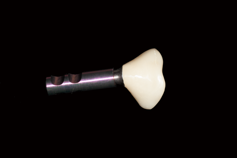 Abb. 9: Sealing-Socket-Abutment: labside