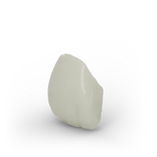 Veneers