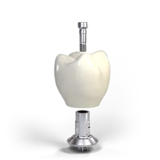 Implant-borne crowns
