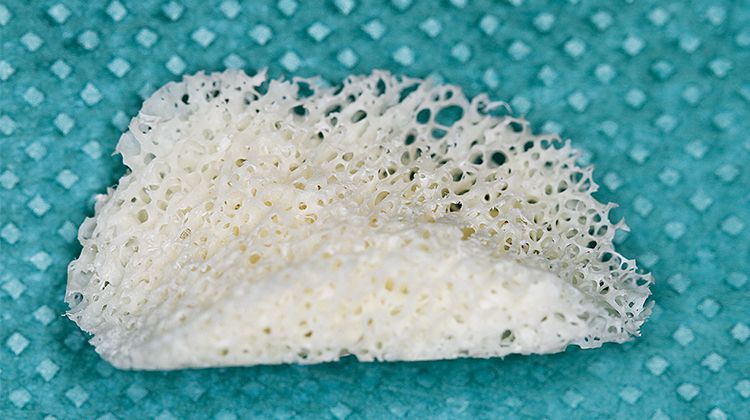 Fig. 8 Sterile supplied bone block (botiss)