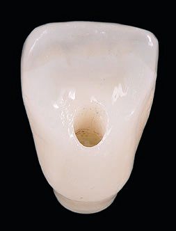 Abb. 14c