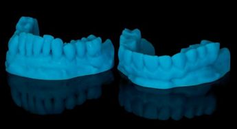 Abb. 23: Sedimentfreies 3D-Drucker-Resin (derzeit in der Entwicklung). Die Farbe Blau ist für dentale Anwendungen undenkbar; hier handelt es sich um ein Bild aus der Entwicklungsphase