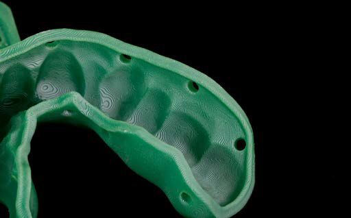 Abb. 6: Im Materialportfolio stehen verschiedene 3D-Resine für Löffel zur Verfügung. Transparentes Material kann bei Implantat-Abformungen von Vorteil sein. Die manuelle Nacharbeit ist auf ein Minimum reduziert.