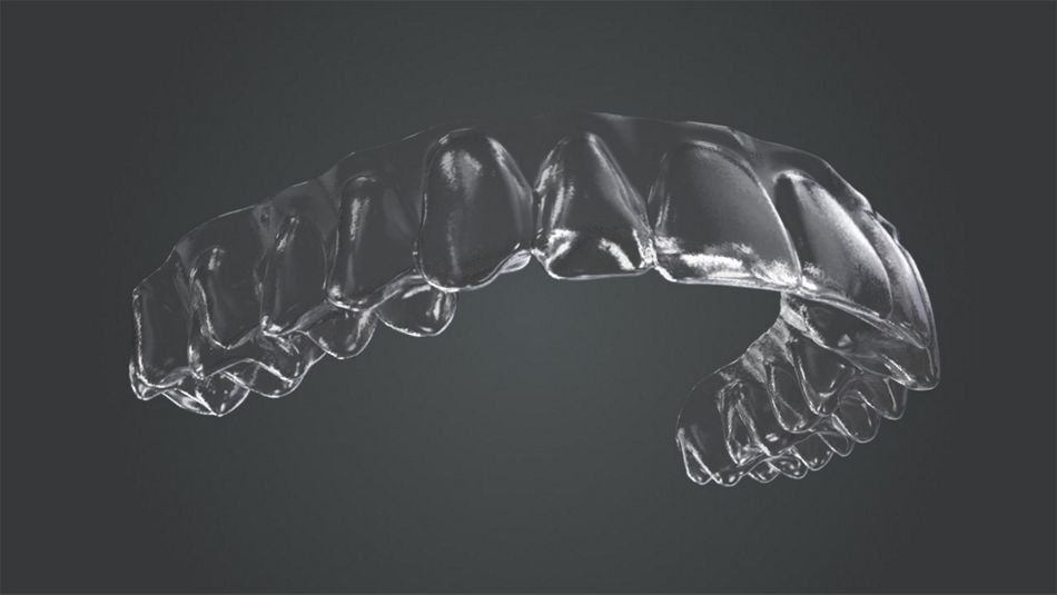Abb. 5: Beispiel für einen ClearCorrect-Aligner. Typisch ist die glatte, gerade verlaufende Trimline, die sich über den Gingivarand erstreckt. Abbildung: Straumann Group