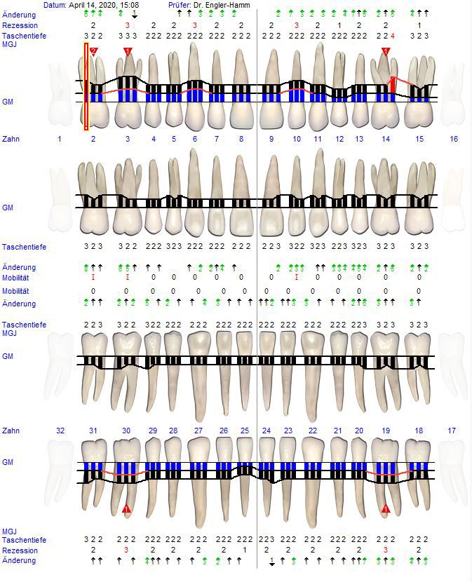 Abb. 4: Reevaluation nach 6 Wochen: Parodontalstatus