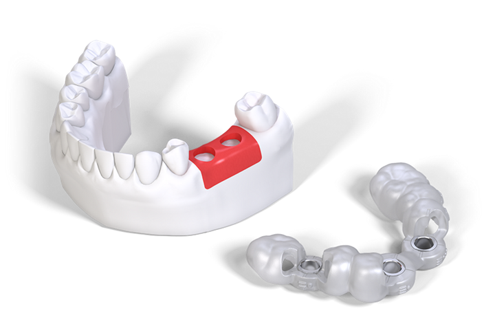 Straumann Centralized Production