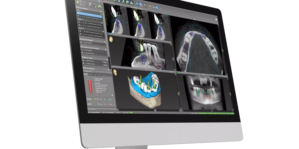 Digital Dental Planning and Design Software | Dental Implants and ...