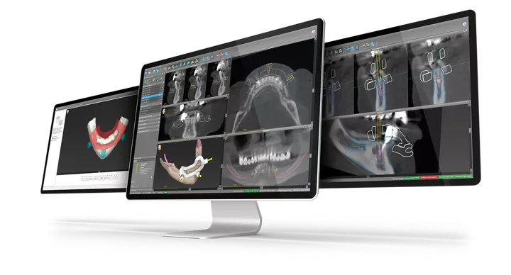 Digital for Labs - Straumann products