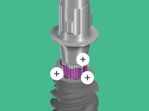 Straumann® BLXインプラントシステム｜ストローマン・ジャパン