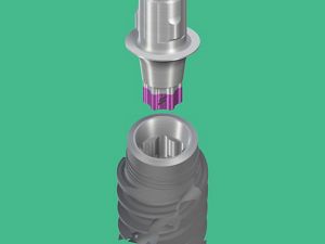 ストローマン Straumann BLX インプラント ストローマンBLXについて｜目黒まついデンタルクリニック｜目黒