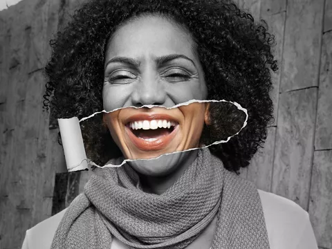 Esthetics & Biomaterials