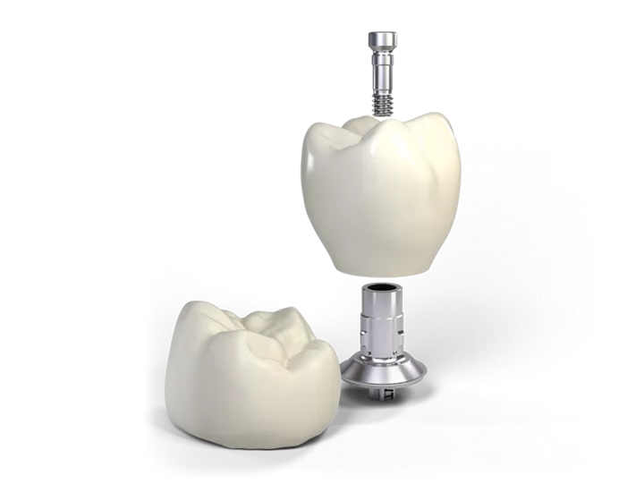 single tooth crown in ti-base