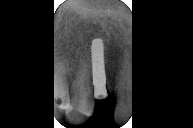 fig. 11