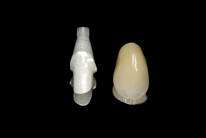 fig. 16